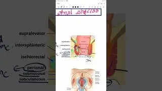 anal abscess |surgery revision video| #inicet #neetpg #neetpg2024 #neet #surgery #upsccms