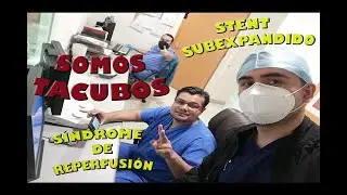 Angioplastia sobre Descendente Anterior y Circunfleja con los Tacubos