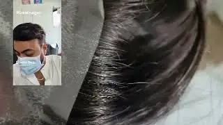 Front line hair patch in himatnagar available by Decent hair wig expert call 🤙 9974174602