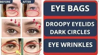 Face yoga Exercise for eyelift, AntiAging,remove wrinkles,DarkCircles #faceyoga#eyelift#youthfullook