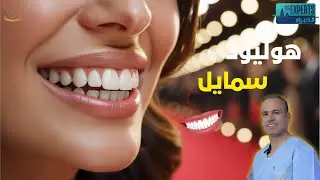هوليود سمايل..مع الدكتور مجدوب في برنامج الخبراء القناة الثانية