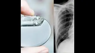 Radiography of Contemporary Cardiac Devices DR  Ahmed Abd Elsamed
