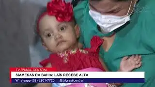 LAÍS, UMA DAS GÊMEAS SIAMESAS OPERADAS EM GOIÂNIA, RECEBE ALTA HOSPITALAR