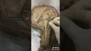 El Enc&eacute;falo