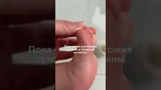 Артикул на крем с мочевиной #WW124265  копируй с двумя WW  РП