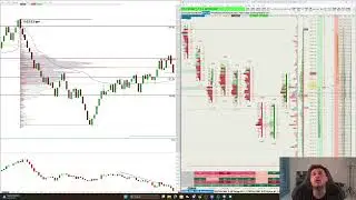 Live Trade Breakdown Making $48,435 (on Choppy Conditions)