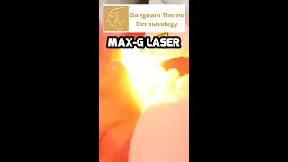 Max G Laser Treatment - Theme Dermatology