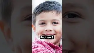 People With Dimples Should Watch This | Amazing Facts #shorts