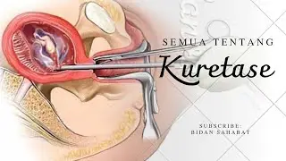 KAMU AKAN DIKURET?? TONTON DULU VIDEO INI!