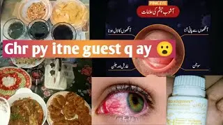 mujy bi Eye's flu ho gya 🥺🥴|Conjunctivitis|Ghr py itne zyda guest ay gya 😮||Ayeshm vlogger 🤩