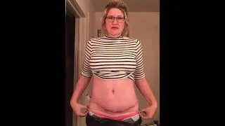Mommy makeover journey