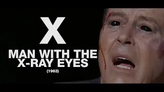 X Man With The X-Ray Eyes - A Cautionary Tale