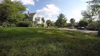 Mowing your lawn is #NotaLuxury....neither are prosthetics