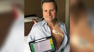 Wireless monitoring of a cardiac surgery patient at home