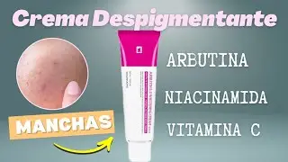 TOSOWOONG|ARBUTIN 5.0 KOREAN DEPIGMENTING/WHITENING CREAM🇰🇷