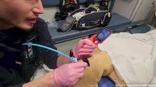 McGrath Video Scope Intubation