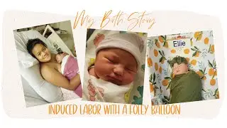 My Birth Story | Foley Balloon Induction