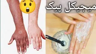 whitening  effect from baking soda |بیکنگ سوڈے سے وائٹنگ افیکٹ |skin care