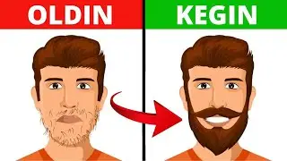 SOQOL OʻSTIRISHNI ENG ARZON USULI | Soch va soqol oʻstirish 🧔🏻&zwj;♂️