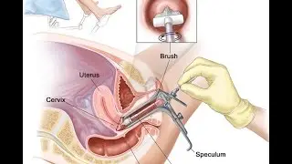 Cervical Biopsy | NYS Approved | Brooklyn Abortion Clinic