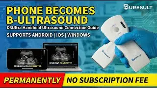 How to Connect a Handheld Ultrasound to a Phone | Suresult D3Ultra Setup Guide