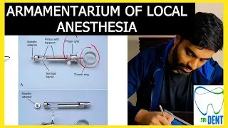 The Stu DENT - Armamentarium of Local Anesthesia (the tools of the trade)