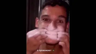 #улыбка #зубы