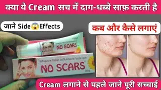 क्या ये Cream सच में दाग-धब्बे साफ़ करती है | No Scars Cream Review | How to use no scars cream 