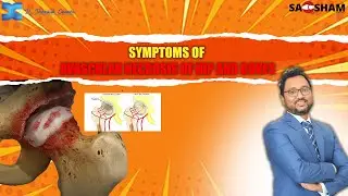 Early Signs of AVN: Symptoms of Avascular Necrosis in Hip and Bone Joints