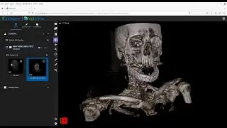Demo of Kitware's VolView plugin for Orthanc
