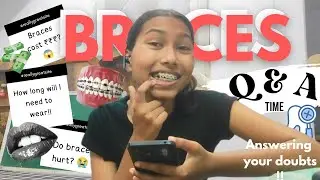 Braces Q&A: Answering Your Most Asked Questions!🦷😱 #braces #bracestreatment 