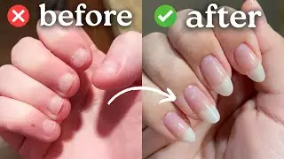 КАК БЫСТРО ОТРАСТИТЬ НОГТИ! (10 простых советов)
