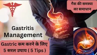 गैस्ट्रिक का इलाज | गैस की समस्या का समाधान ।Gastritis Management #gastritis #acidity #doctors 