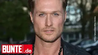 Nico Schwanz &ndash; Sch&ouml;nheits-OPs! Das hat er alles machen lassen