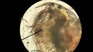 Cladoceran (water flea)