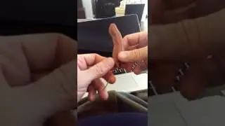 FilaFlex Prosthetic Finger