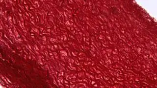 Elastic Fibers, Aorta Orcein stain
