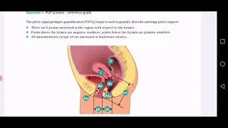 UV PROLAPSE