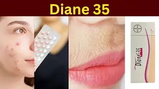 Tabletki Diane 35 | Recenzja tabletek Diane 35 | Jak stosować tabletki Diane | Diane 35 | Działan...