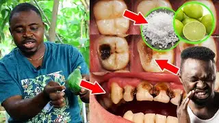 Use pawpaw body water, salt, and lemon to cure decayed teeth.