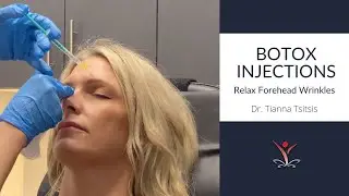 Relax Forehead Wrinkles and the Glabellar with Botox&reg;