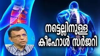 Dr. Q : നട്ടെല്ലിനുള്ള കീഹോള്‍ സര്‍ജറി | Keyhole Spinal Surgery  | 29th January 2019