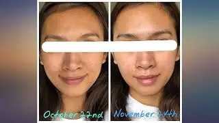 ECO FACE Near-infrared LED Mask for Home Facial LED Therapy | with Brightening revieww