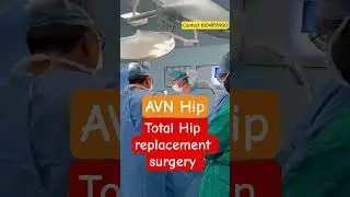 Total Hip replacement surgery in Jaipur
