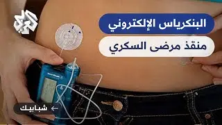 البنكرياس الإلكتروني.. هل يكون منقذا لمرضى السكر من حقن الأنسولين اليومية؟