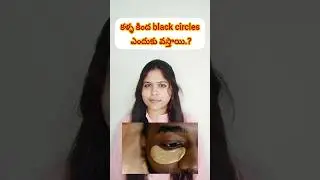 Young age లోనే dark circles?   ఎందుకు?#shorts#drsuprajajadhav #shortfeed #healthtips#darkcircles