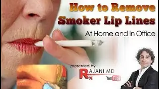 How to Treat Smokers Lip Lines At Home and in The Office Solutions