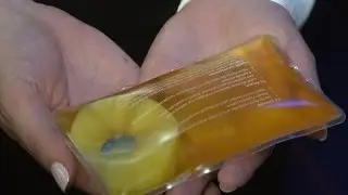 mFluidX&rsquo;s diagnostic test kit to diagnose infectious diseases