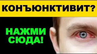 Points for conjunctivitis | Eastern methods for relieving inflammation