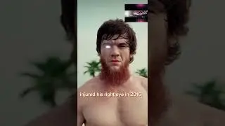 How did SHARA BULLET MAGOMEDOV lose an eye? #ufc # #ufcfighter #shara